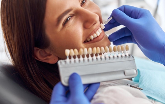 carillas dentales catarroja carillas dentales valencia