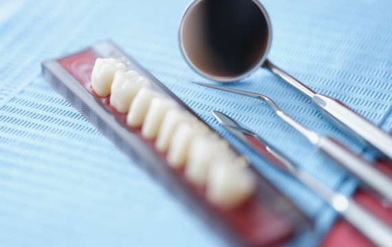 coronas dentales catarroja coronas dentales valencia