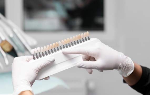 cuanto-cuesta-un-blanqueamiento-dental-en-Catarroja cuanto-cuesta-un-blanqueamiento-dental-en-Valencia