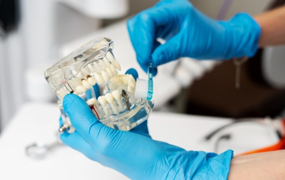 cuanto-tiempo-dura-el-proceso-de-protesis-sobre-implantes-en-catarroja cuanto-tiempo-dura-el-proceso-de-protesis-sobre-implantes