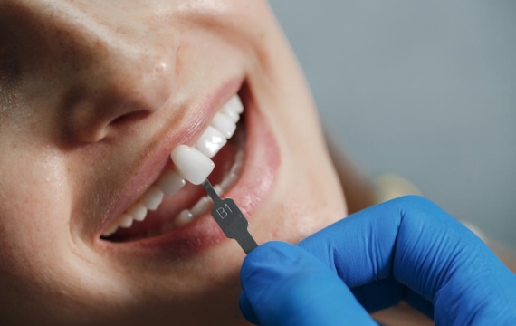 Clinica Dental Jaime I en Catarroja Clinica Dental Jaime I en Valencia