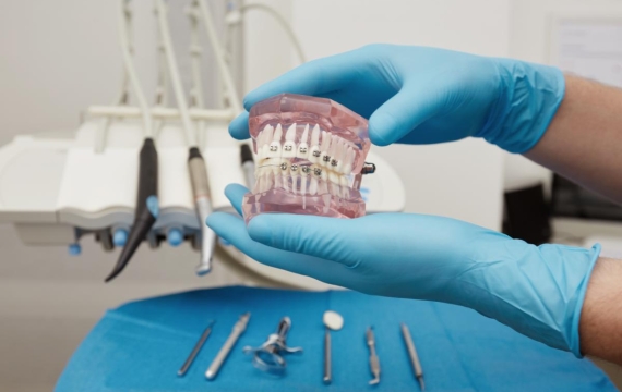 dentista-mostrando-modelo-de-plastico-dental-con-tirantes dentista-mostrando-modelo-de-plastico-dental-con-tirantes