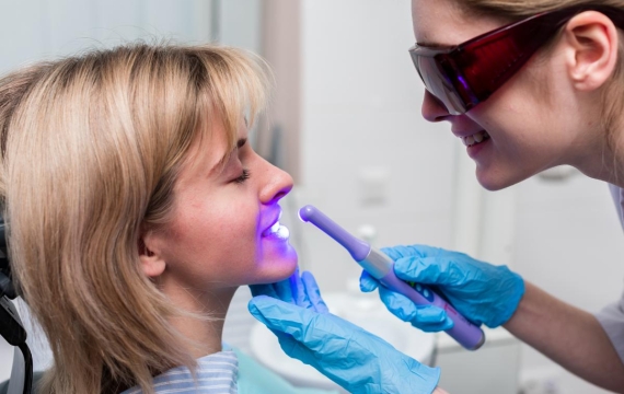 Blanqueamiento Dental en consulta Catarroja Blanqueamiento Dental en consulta