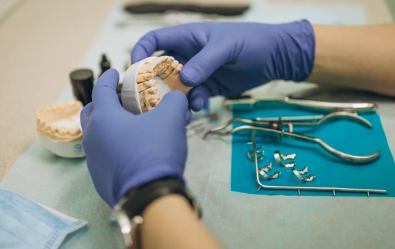 el-dentista-esta-sosteniendo-pinzas-para-carillas-y-coronas-de-ceramica-dental-catarroja el-dentista-esta-sosteniendo-pinzas-para-carillas-y-coronas-de-ceramica-dental