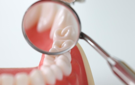 limpieza dental limpieza dental