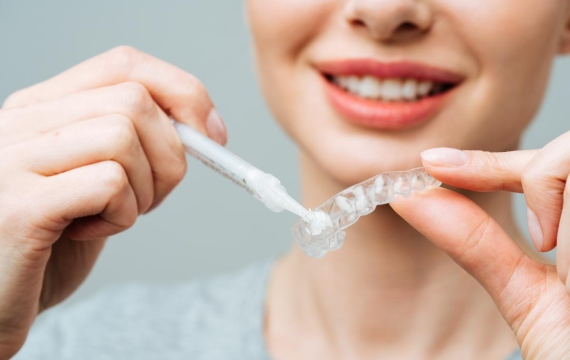 limpieza alineadores limpieza alineadores