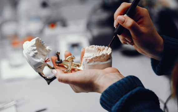 explicacion tipo implante catarroja explicacion tipo implante