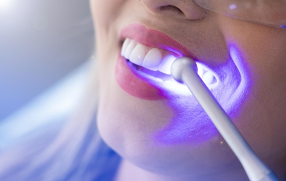 mujer-con-los-dientes-revisados-por-el-dentista-catarroja mujer-con-los-dientes-revisados-por-el-dentista