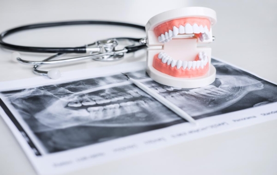 protesis dentales catarroja protesis dentales Valencia