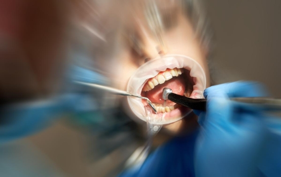 regeneracion-osea-guiada-Catarroja regeneracion-osea-guiada-Valencia