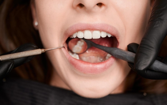 causas-y-factores-de-riesgo-de-la-caries-dental