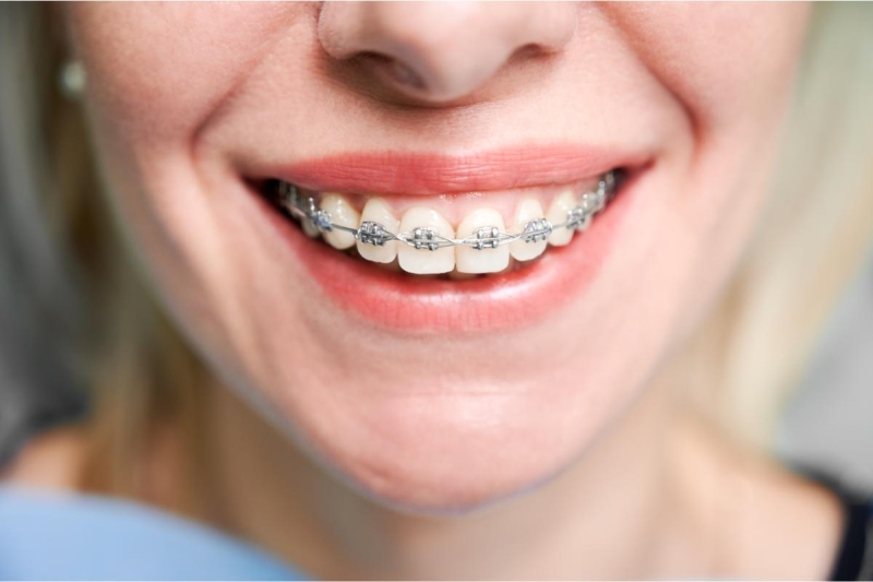 uso-de-brackets