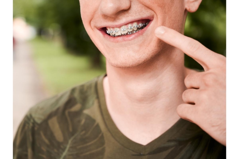 ortodoncia-correctiva-tratamiento