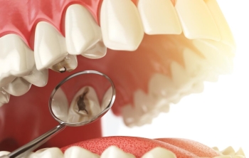 odontología general en Valencia