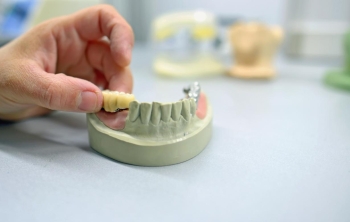 protesis-dentales-en-el-laboratorio-en-Valencia