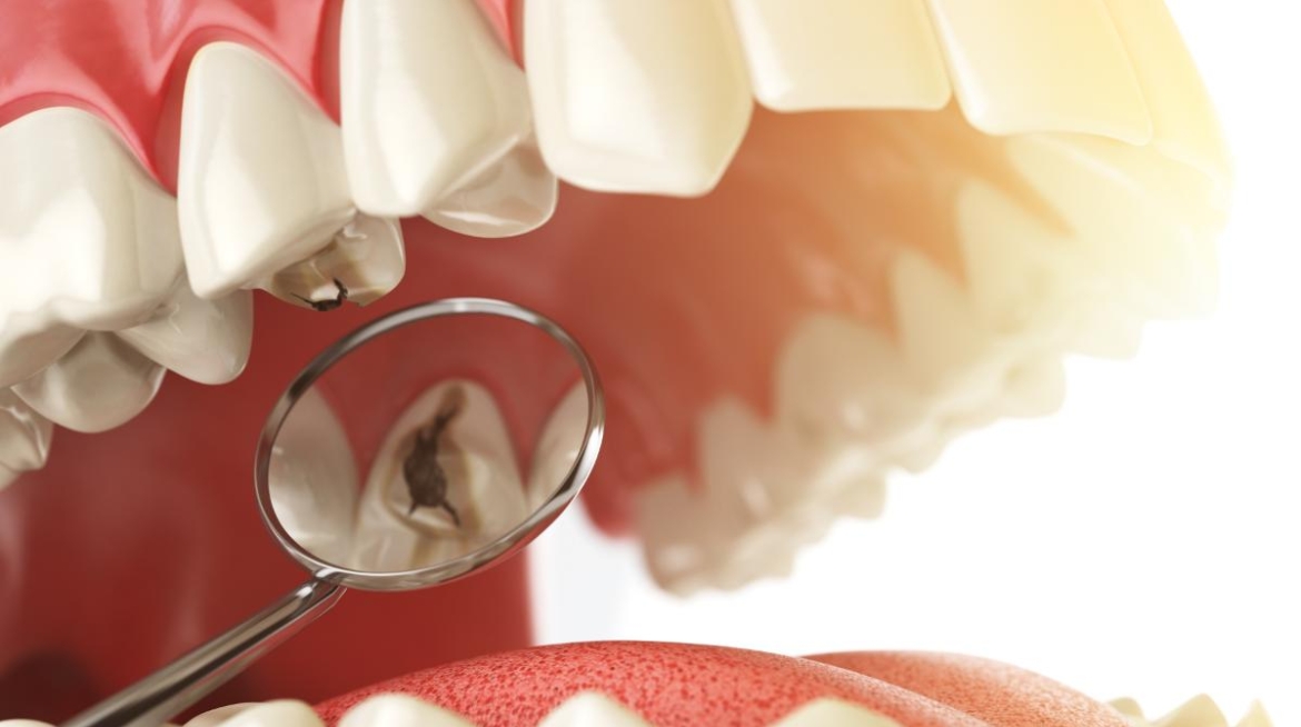 odontología general en Catarroja odontología general en Valencia