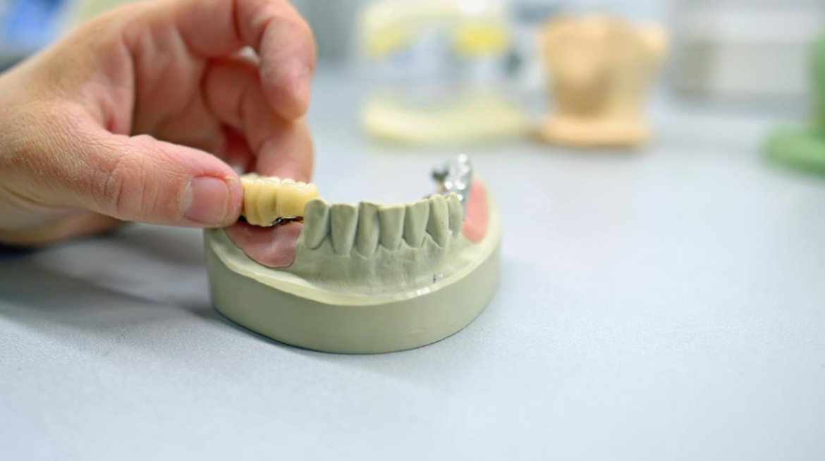 protesis-dentales-en-el-laboratorio-en-Catarroja protesis-dentales-en-el-laboratorio-en-Valencia