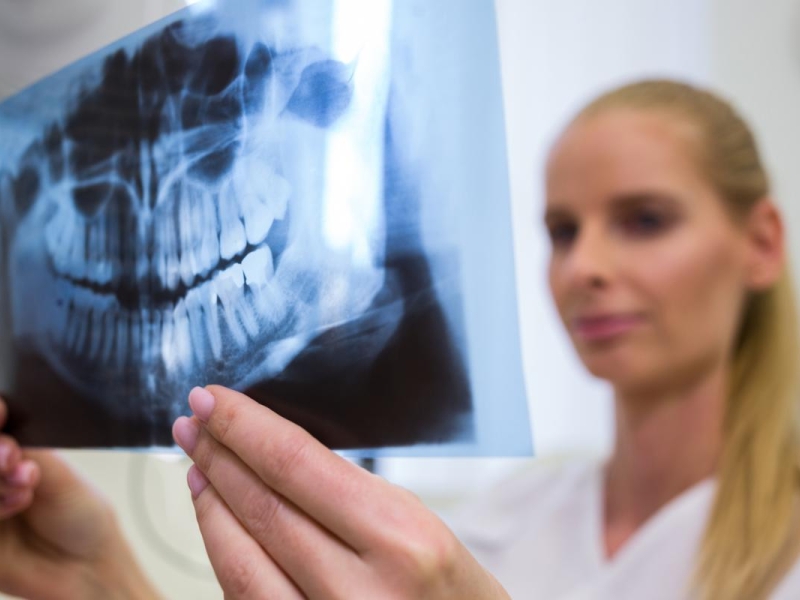 Ortopedia maxilar Catarroja Ortopedia maxilar Valencia