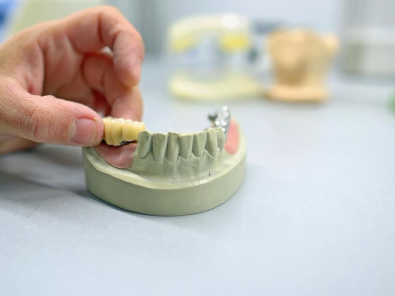 protesis-dentales-en-el-laboratorio-en-Catarroja protesis-dentales-en-el-laboratorio-en-Valencia